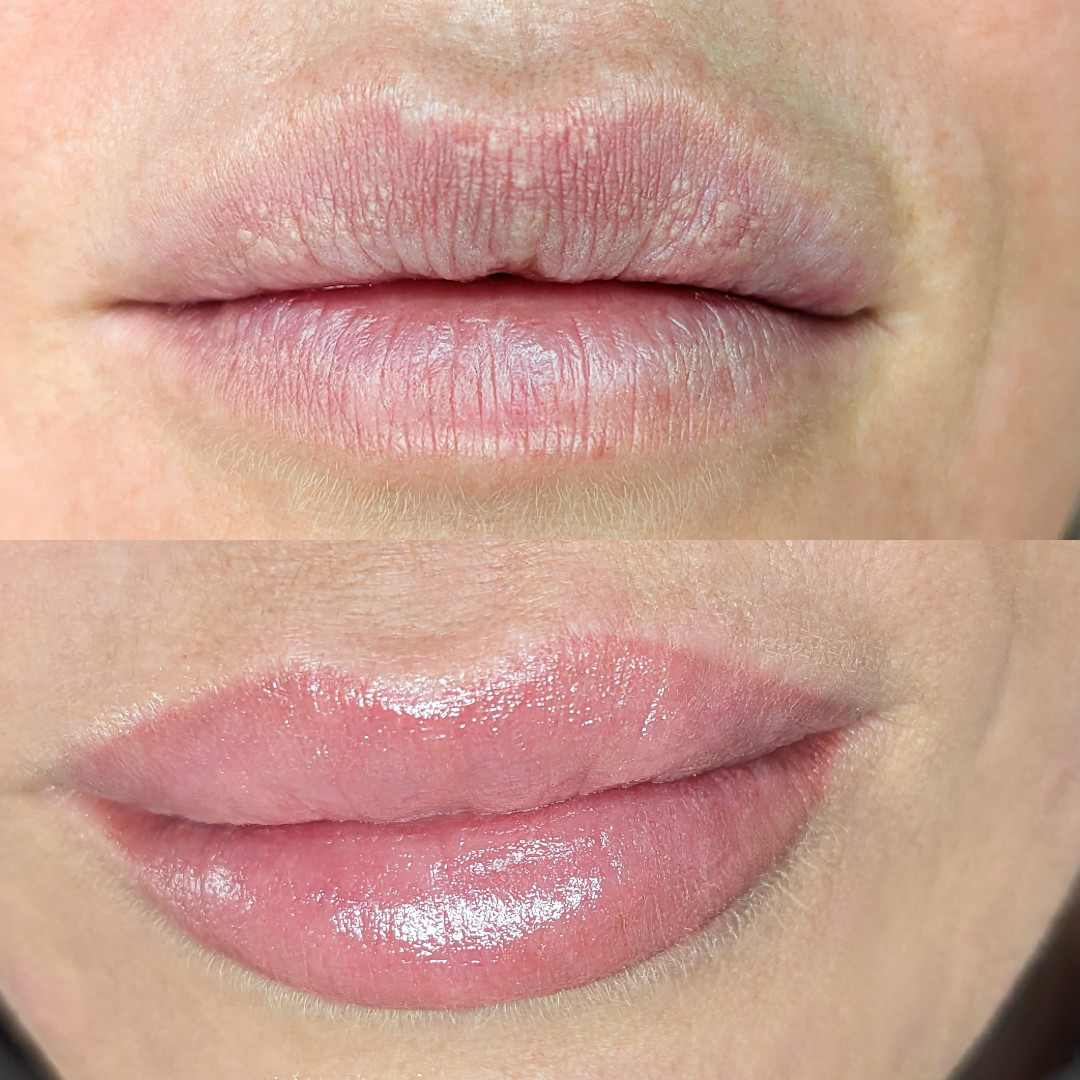 Permanent Make-up Lippen vorher/nachher