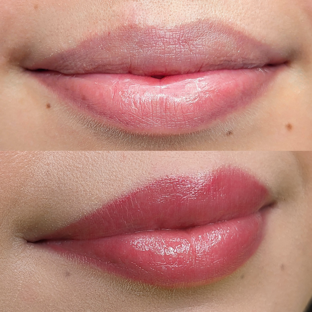 Permanent Make-up Lippen vorher/nachher