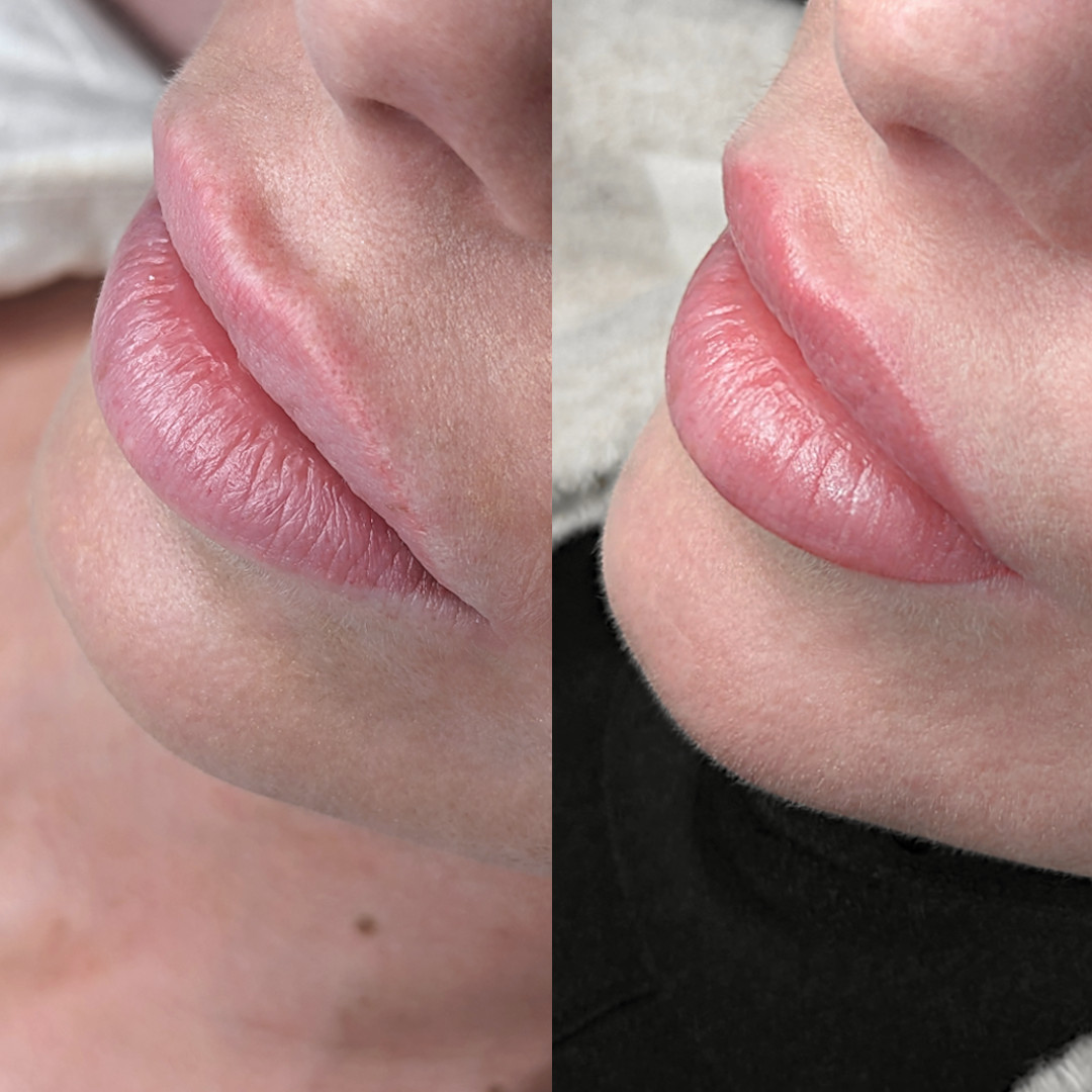 Permanent Make-up Lippen vorher/nachher