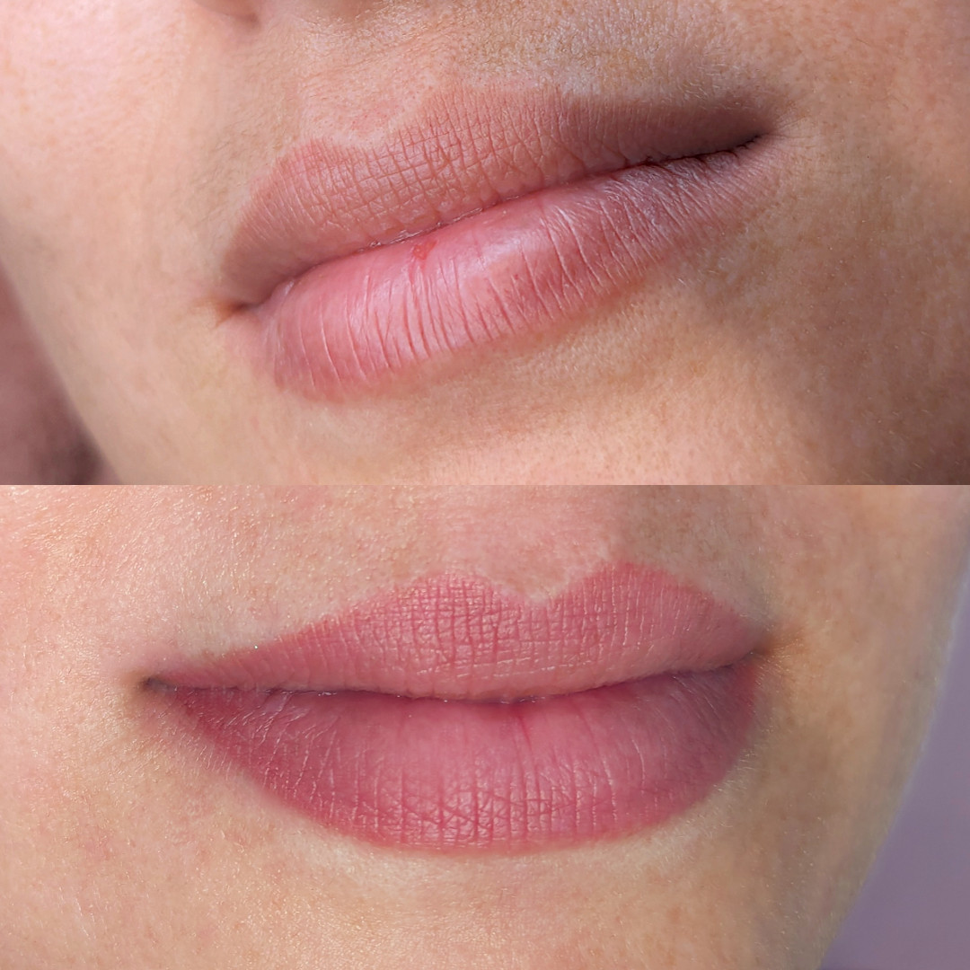 Permanent Make-up Lippen vorher/nachher