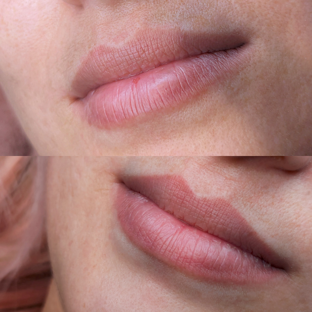 Permanent Make-up Lippen vorher/nachher